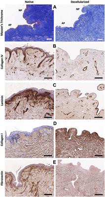 Reconstruction of the human nipple–areolar complex: a tissue engineering approach